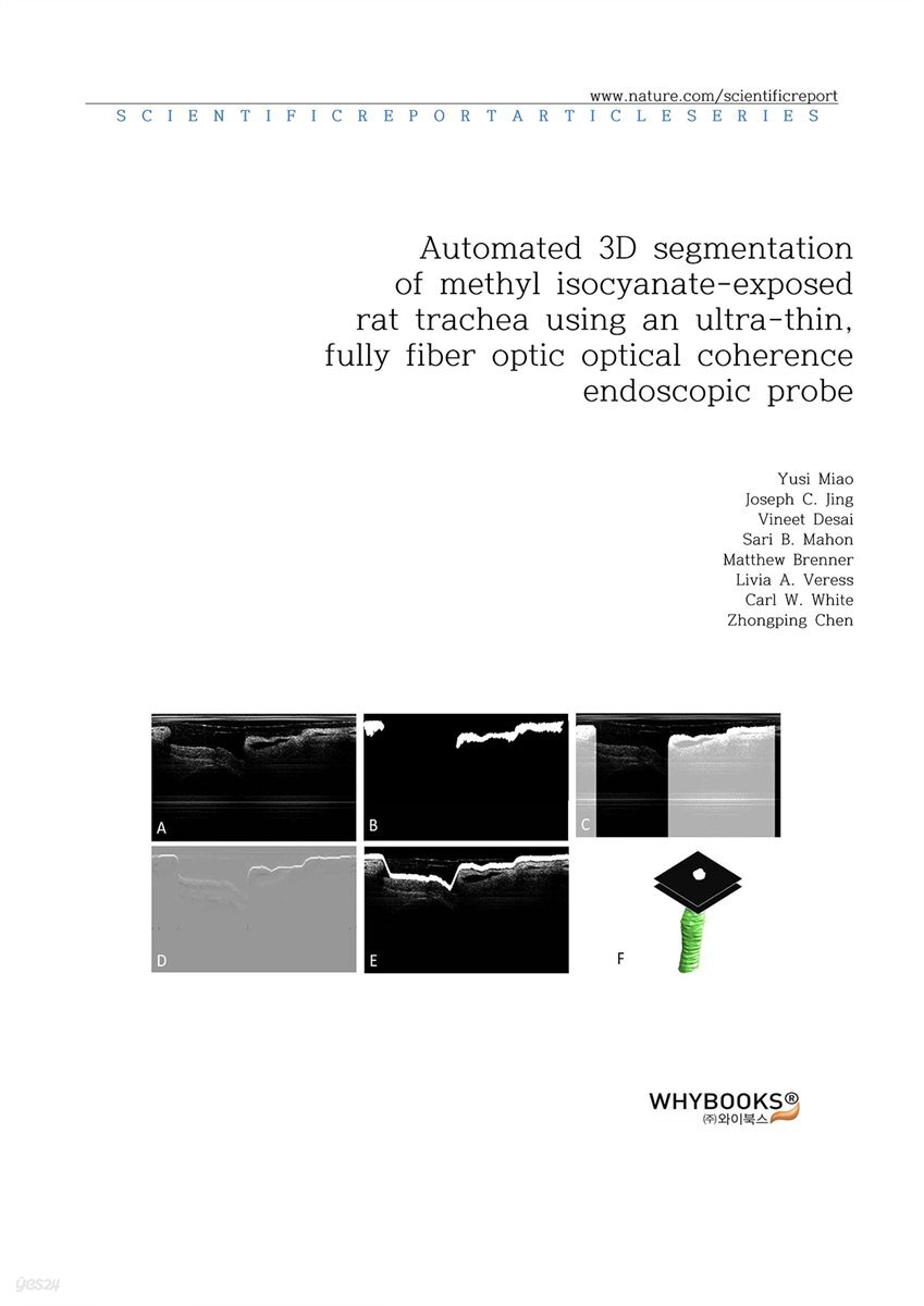 Automated 3D segmentation of methyl isocyanateexposed rat trachea using an ultrathin, fully fiber optic optical coherence endoscopic probe