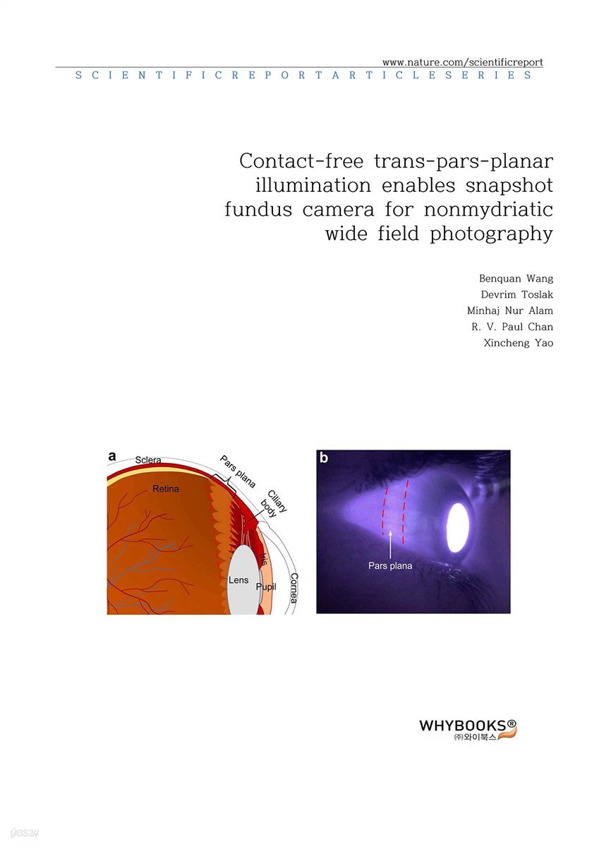 Contact-free trans-pars-planar illumination enables snapshot fundus camera for nonmydriatic wide field photography