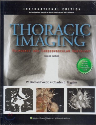 Thoracic Imaging Pulmonary And Cardiovascular Radiology, 2/E (IE)
