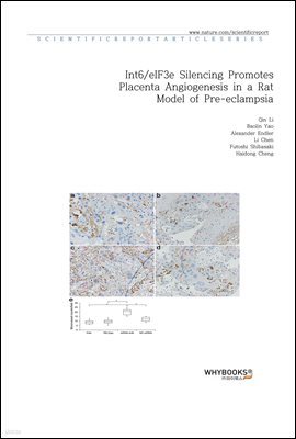 Int6. eIF3e Silencing Promotes Placenta Angiogenesis in a Rat Model of Pre-eclampsia