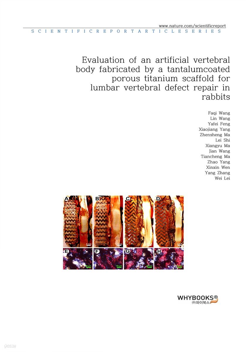 Evaluation of an artificial vertebral body fabricated by a tantalum-coated porous titanium scaffold for lumbar vertebral defect repair in rabbits