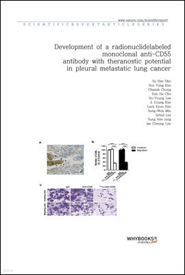 Development of a radionuclide-labeled monoclonal anti-CD55 antibody with theranostic potential in pleural metastatic lung cancer