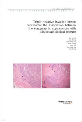 Triple-negative invasive breast carcinoma the association between the sonographic appearances with clinicopathological feature