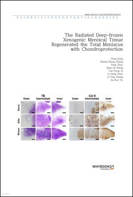 The Radiated Deep-frozen Xenogenic Meniscal Tissue Regenerated the Total Meniscus with Chondroprotection