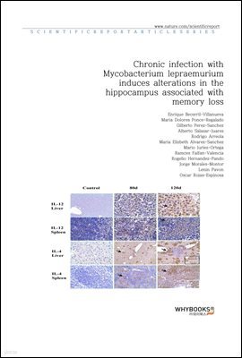 Chronic infection with Mycobacterium lepraemurium induces alterations in the hippocampus associated with memory loss
