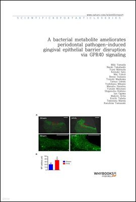 A bacterial metabolite ameliorates periodontal pathogen-induced gingival epithelial barrier disruption via GPR40 signaling