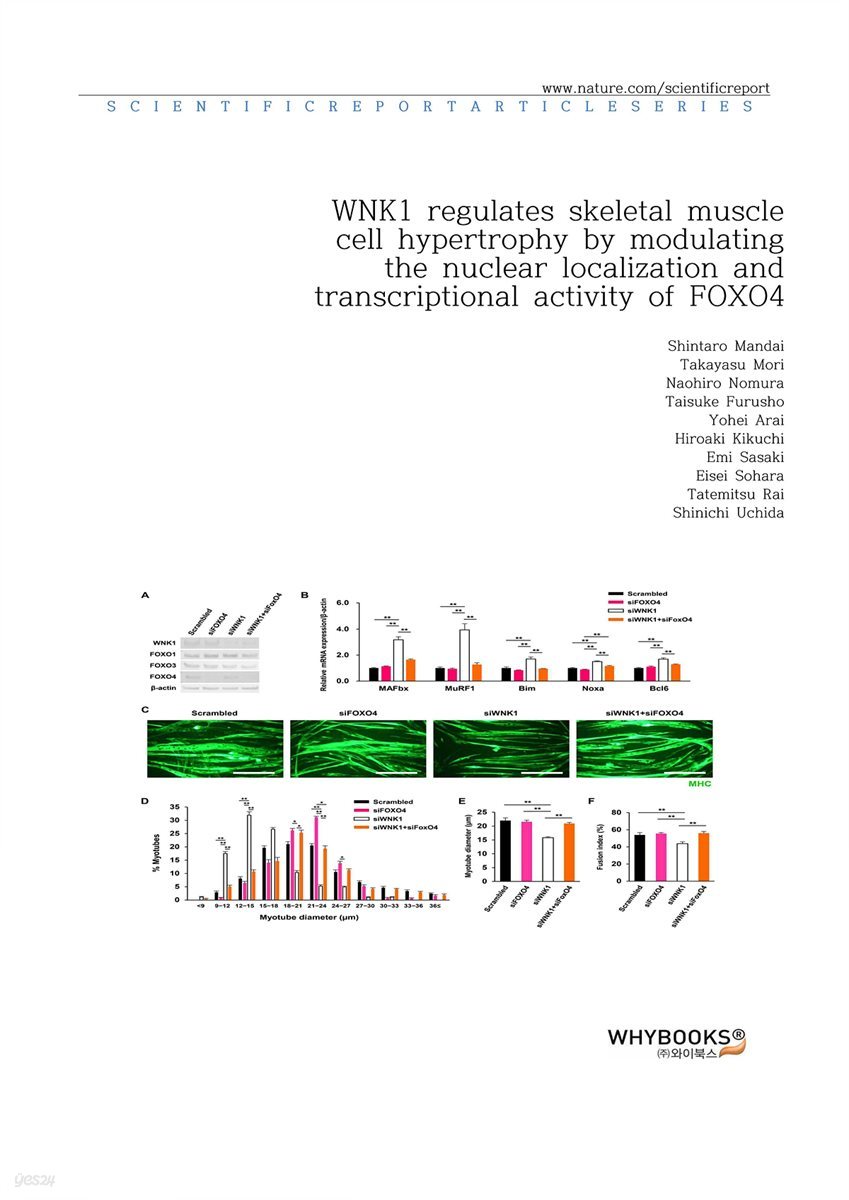 WNK1 regulates skeletal muscle cell hypertrophy by modulating the nuclear localization and transcriptional activity of FOXO4