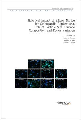 Biological Impact of Silicon Nitride for Orthopaedic Applications Role of Particle Size, Surface Composition and Donor Variation