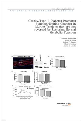 ObesityType II Diabetes Promotes Function-limiting Changes in Murine Tendons that are not reversed by Restoring Normal Metabolic Function