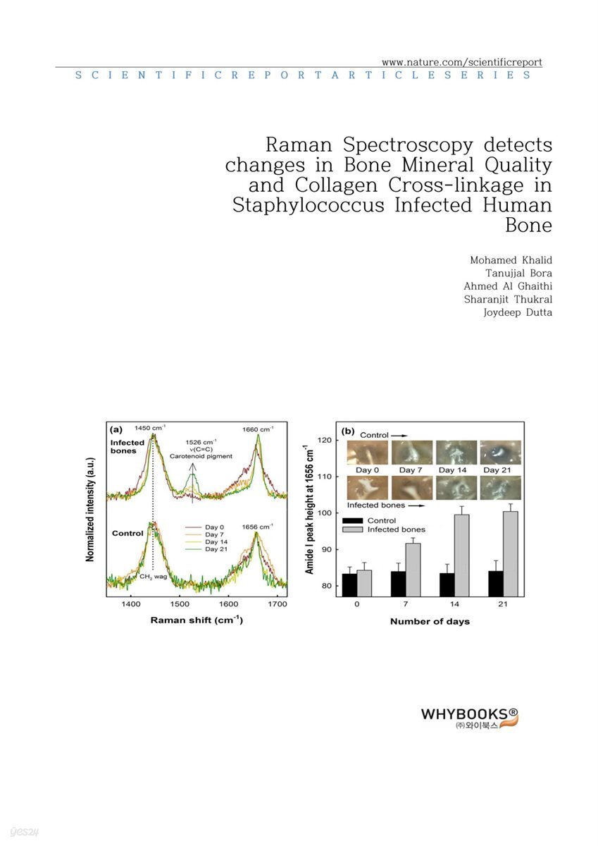 Raman Spectroscopy detects changes in Bone Mineral Quality and Collagen Cross-linkage in Staphylococcus Infected Human Bone