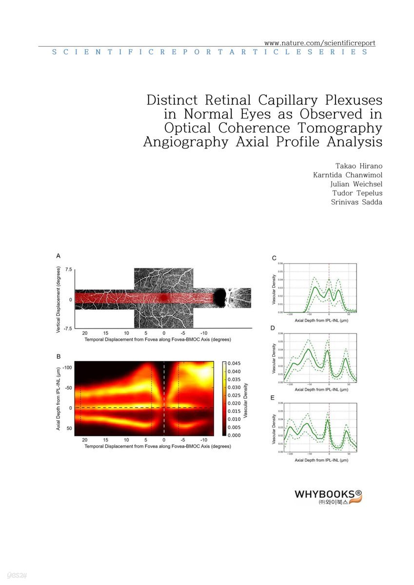 Distinct Retinal Capillary Plexuses in Normal Eyes as Observed in Optical Coherence Tomography Angiography Axial Profile Analysis