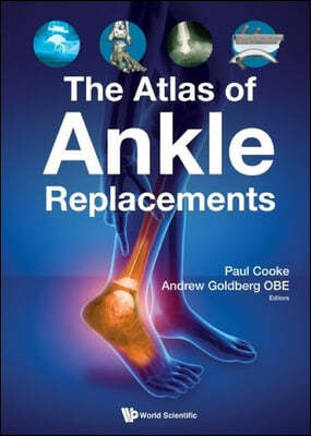 Atlas Of Ankle Replacements, The