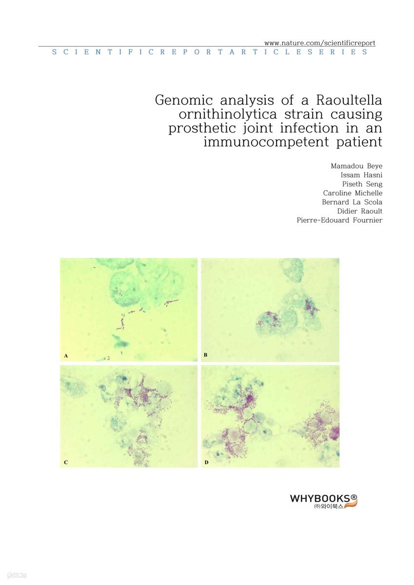 Genomic analysis of a Raoultella ornithinolytica strain causing prosthetic joint infection in an immunocompetent patient