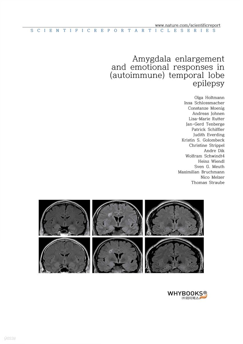 Amygdala enlargement and emotional responses in (autoimmune) temporal lobe epilepsy