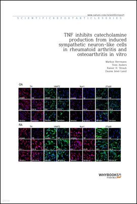 TNF inhibits catecholamine production from induced sympathetic neuron-like cells in rheumatoid arthritis and osteoarthritis in vitro