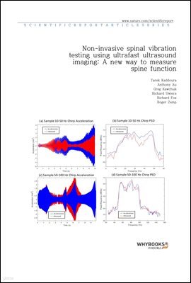 Non-invasive spinal vibration testing using ultrafast ultrasound imaging A new way to measure spine function