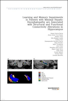 Learning and Memory Impairments in Patients with Minimal Hepatic Encephalopathy are Associated with Structural and Functional Connectivity Alterations in Hippocampus