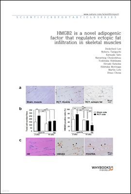 HMGB2 is a novel adipogenic factor that regulates ectopic fat infiltration in skeletal muscles