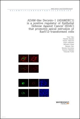 ADAM-like Decysin-1 (ADAMDEC1) is a positive regulator of Epithelial Defense Against Cancer (EDAC) that promotes apical extrusion of RasV12-transformed cells