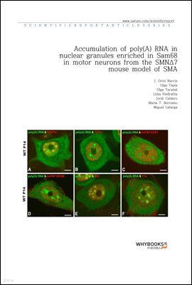 Accumulation of poly(A) RNA in nuclear granules enriched in Sam68 in motor neurons from the SMN7 mouse model of SMA