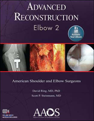 Advanced Reconstruction: Elbow 2: Print + eBook with Multimedia