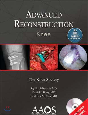 Advanced Reconstruction: Knee: Print + eBook with Multimedia