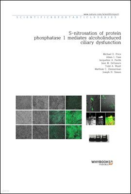 S-nitrosation of protein phosphatase 1 mediates alcohol-induced ciliary dysfunction