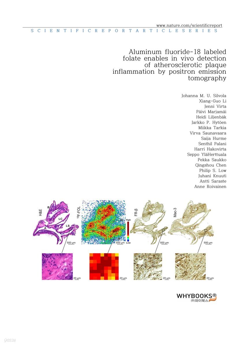 Aluminum fluoride-18 labeled folate enables in vivo detection of atherosclerotic plaque inflammation by positron emission tomography