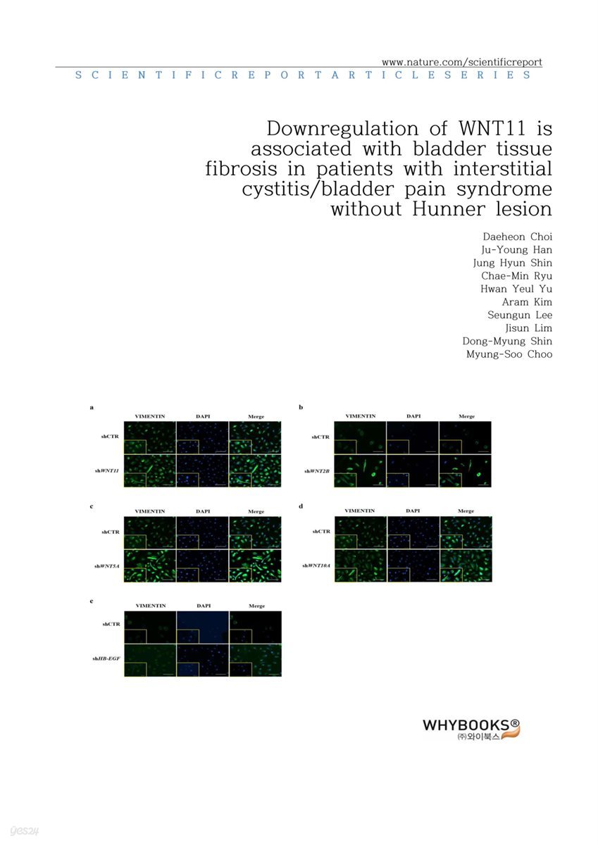 Downregulation of WNT11 is associated with bladder tissue fibrosis in patients with interstitial cystitisbladder pain syndrome without Hunner lesion