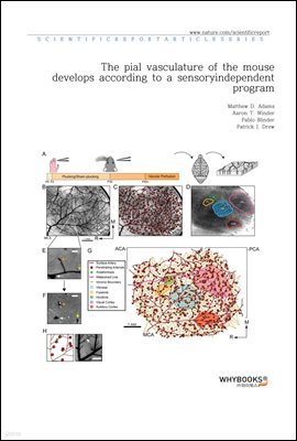 The pial vasculature of the mouse develops according to a sensory-independent program