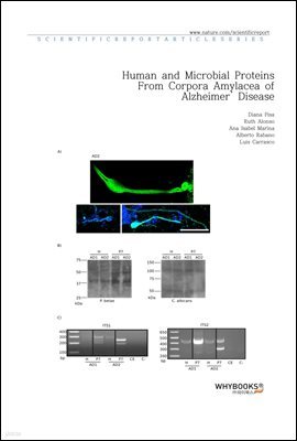 Human and Microbial Proteins From Corpora Amylacea of Alzheimers Disease