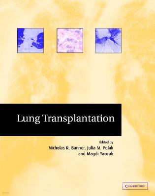 Lung Transplantation