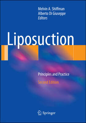 Liposuction