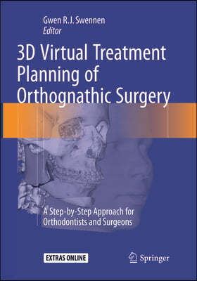 3d Virtual Treatment Planning of Orthognathic Surgery