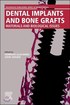 Dental Implants and Bone Grafts: Materials and Biological Issues