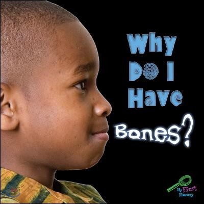 Why Do I Have Bones?