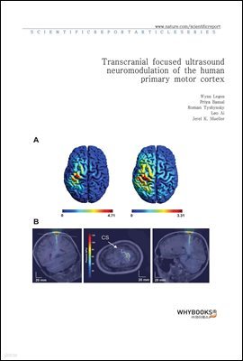 Transcranial focused ultrasound neuromodulation of the human primary motor cortex