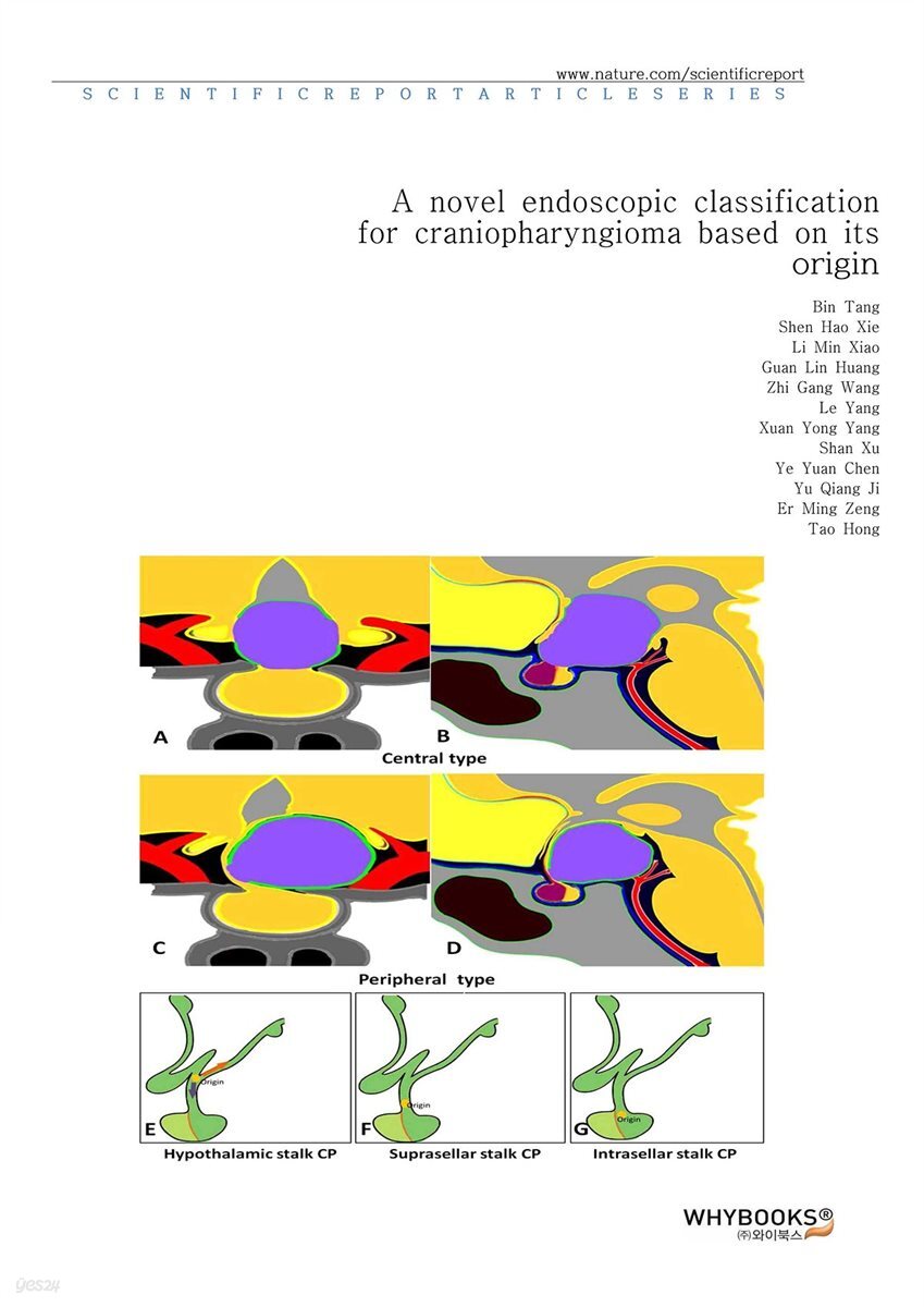 A novel endoscopic classification for craniopharyngioma based on its origin