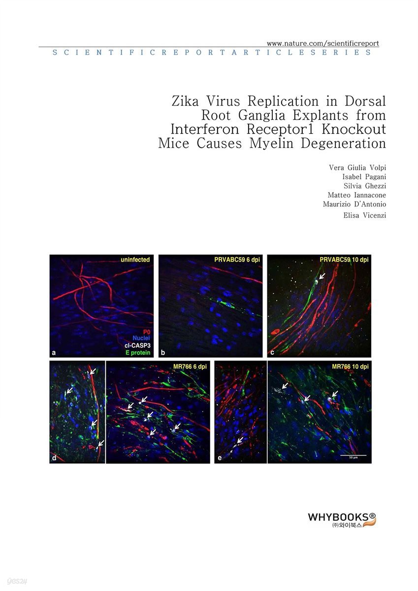 Zika Virus Replication in Dorsal Root Ganglia Explants from Interferon Receptor1 Knockout Mice Causes Myelin Degeneration