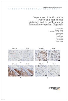 Preparation of Anti-Human Podoplanin Monoclonal Antibody and its application in Immunohistochemical Diagnosis