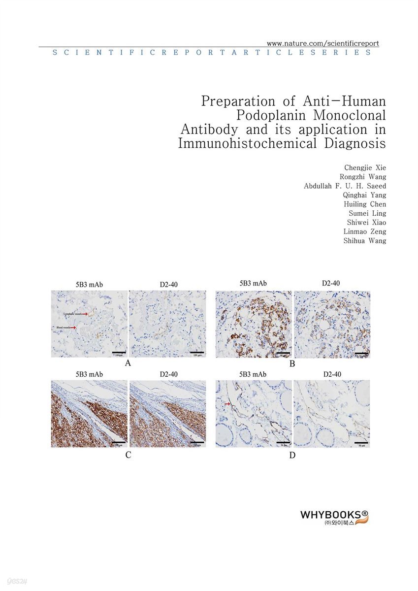 Preparation of Anti-Human Podoplanin Monoclonal Antibody and its application in Immunohistochemical Diagnosis