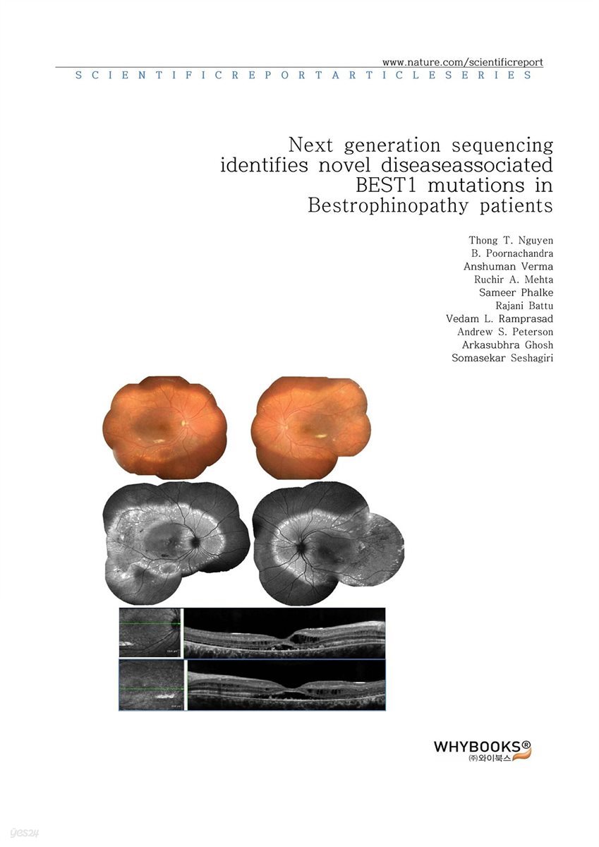 Next generation sequencing identifies novel disease-associated BEST1 mutations in Bestrophinopathy patients