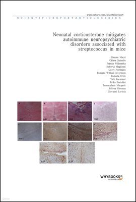 Neonatal corticosterone mitigates autoimmune neuropsychiatric disorders associated with streptococcus in mice