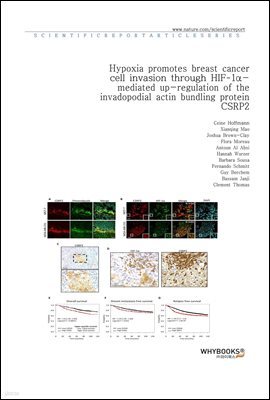 Hypoxia promotes breast cancer cell invasion through HIF-1-mediated up-regulation of the invadopodial actin bundling protein CSRP2