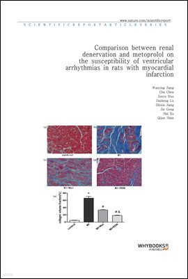 Comparison between renal denervation and metoprolol on the susceptibility of ventricular arrhythmias in rats with myocardial infarction