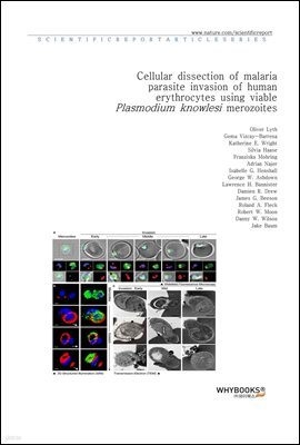 Cellular dissection of malaria parasite invasion of human erythrocytes using viable Plasmodium knowlesi merozoites
