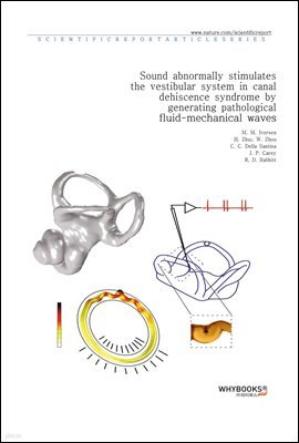 Sound abnormally stimulates the vestibular system in canal dehiscence syndrome by generating pathological fluid-mechanical waves