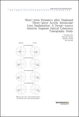 Short-term Dynamics after Single- and Three-piece Acrylic Intraocular Lens Implantation A Swept-source Anterior Segment Optical Coherence Tomography Study