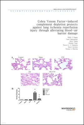 Cobra Venom Factor-induced complement depletion protects against lung ischemia reperfusion injury through alleviating blood-air barrier damage