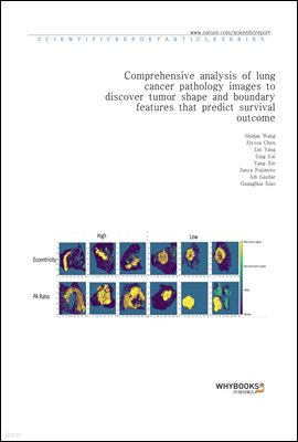 Comprehensive analysis of lung cancer pathology images to discover tumor shape and boundary features that predict survival outcome